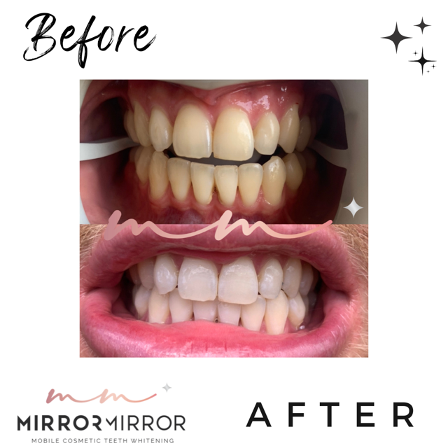 Mirror Mirror Mobile Teeth Whitening